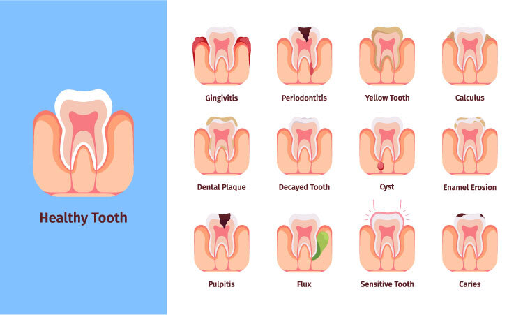 dental-info