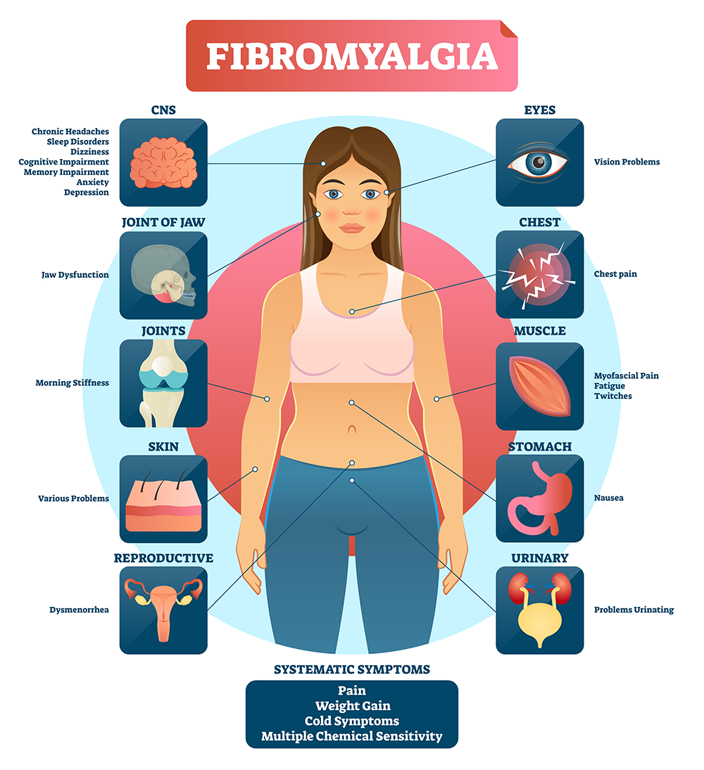 fibromyagia