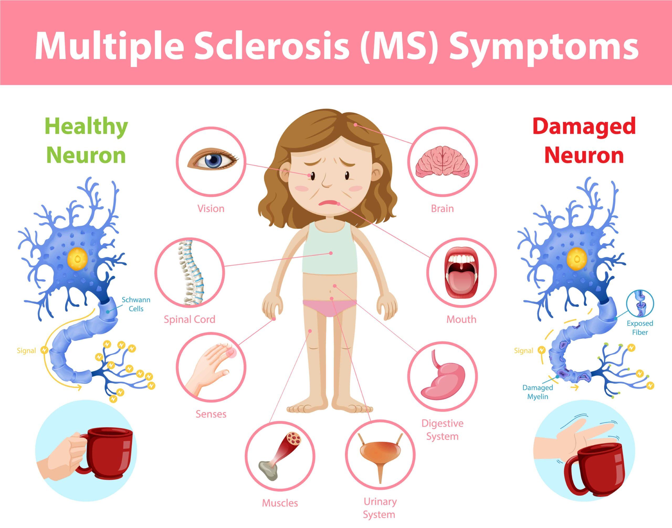 ms-infographic-1-scaled