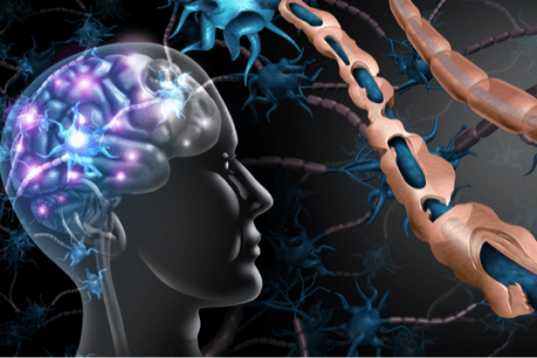 Cannabinoids- Multiple-Sclerosis-min