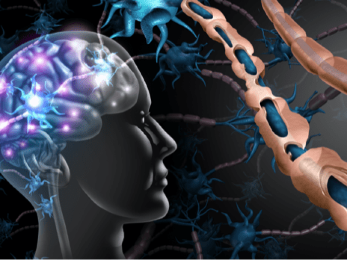 Cannabinoids- Multiple-Sclerosis-min